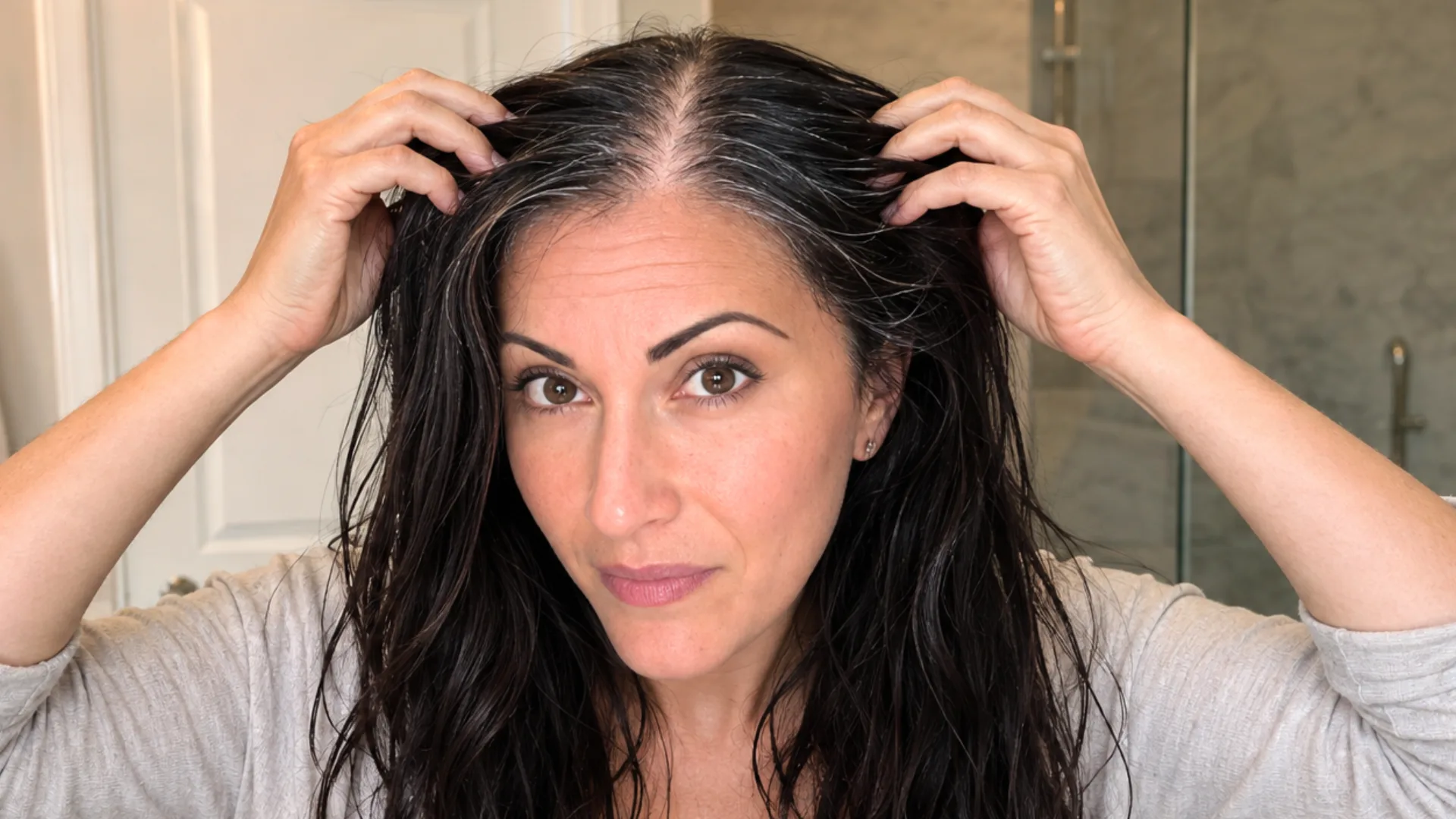 Diane at the beginning of the hair restoration timeline